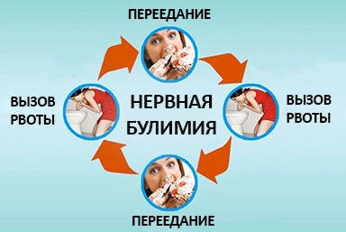 Лечение булимии в Ветлуге